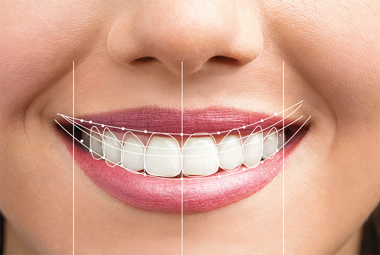 digital smil2
